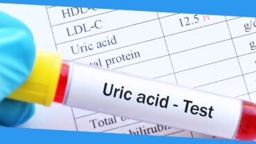 Importance of Uric Acid Levels in Our Body and How Can We Lower It Naturally